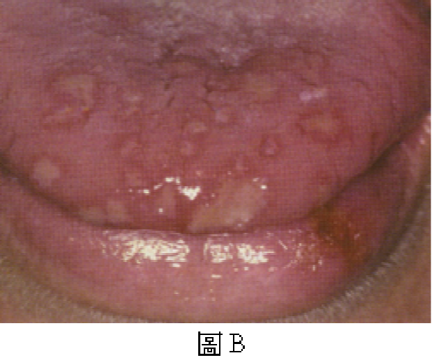 題目圖片
