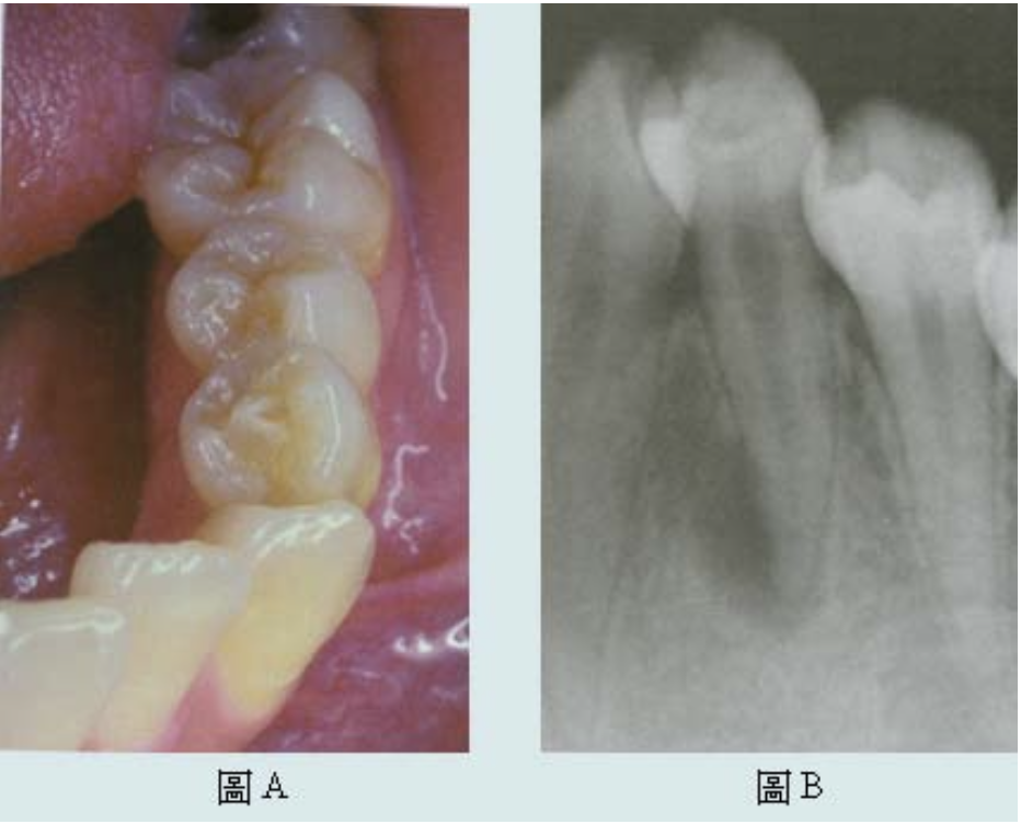 題目圖片